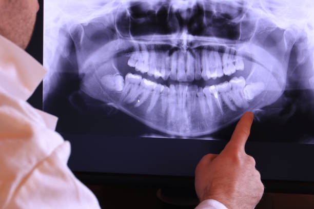 Best Emergency Root Canal Therapy in Eden Prairie, MN